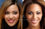 $Beyonce_nariz-nosejob_www_antesydespues_com_ar.jpg