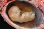 $800px-Human_Embryo_-_Approximately_8_weeks_estimated_gestational_age.jpg