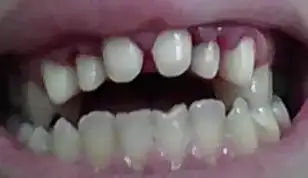 $diş2.webp