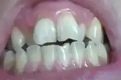 $diş1.webp