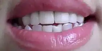 $diş2.webp
