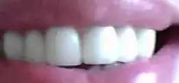 $diş4.webp