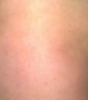 $27042011450.webp