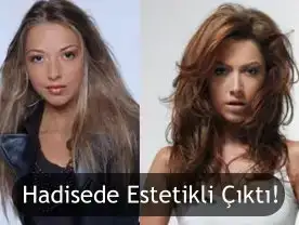 $estetikhadise.webp
