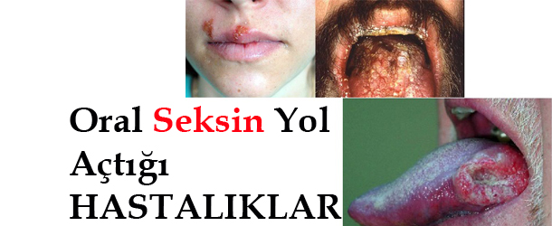 Oral Seks Zararları Nelerdir?