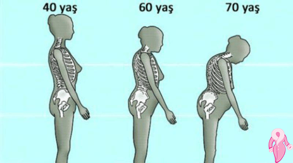 Osteoporoz Diyeti Nasıl Yapılır?