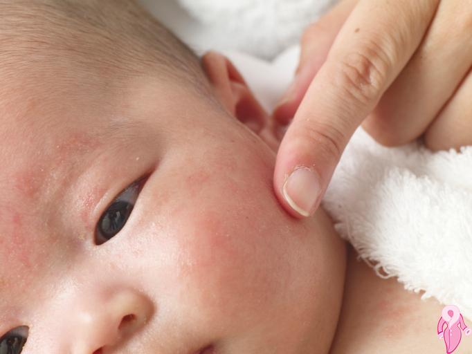 Bebeklerde demir ilacı kullanirken nelere dikkat edilmeli?