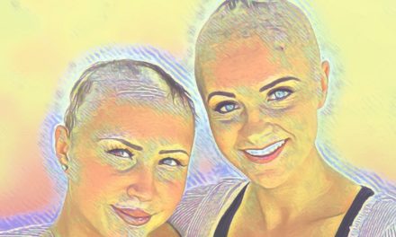 Alopesi Universal: Saç Dökülmesiyle Başa Çıkmanın 6 Yolu