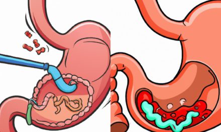 Midede Polip Nedir? 7 Belirtisi, Tanı, Tedavi ve Riskler