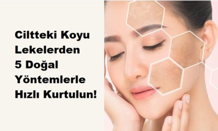 Ciltteki Koyu Lekelerden 5 Doğal Yöntemlerle Hızlı Kurtulun!