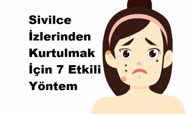 Sivilce İzlerinden Kurtulmak İçin 7 Etkili Yöntem