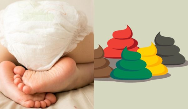Bebeklerde Kaka Renkleri ve Anlamları